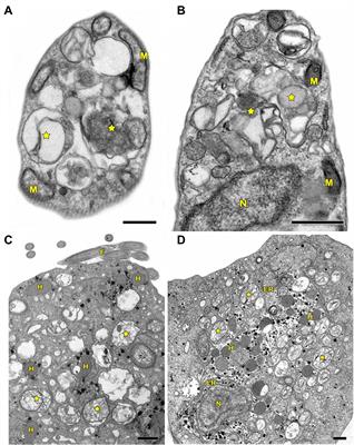 Different Drugs, Same End: Ultrastructural Hallmarks of Autophagy in Pathogenic Protozoa